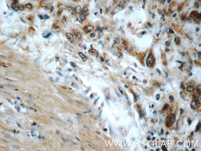 PPP2R3C Antibody in Immunohistochemistry (Paraffin) (IHC (P))