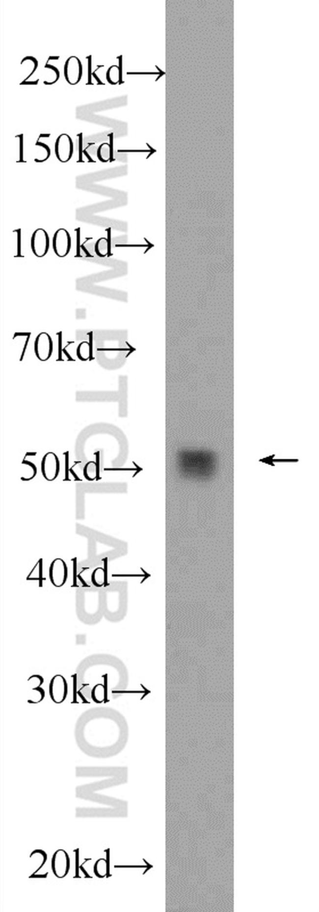 PPP2R3C Antibody in Western Blot (WB)