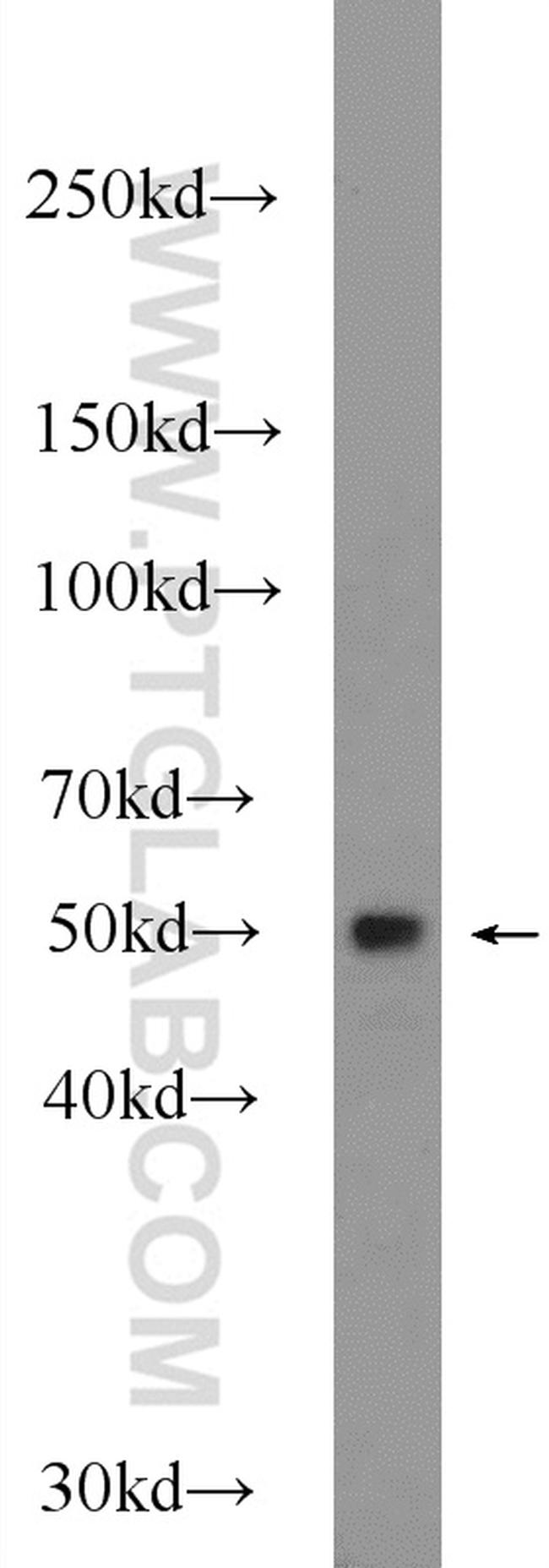 PPP2R3C Antibody in Western Blot (WB)