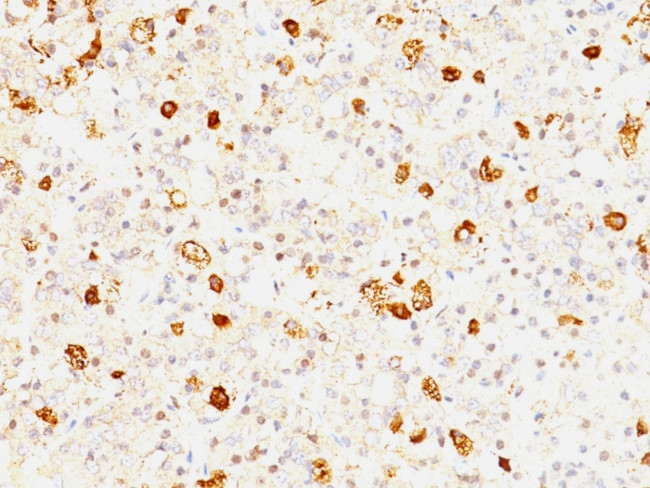 FSH-beta (Follicle Stimulating Hormone-beta) Antibody in Immunohistochemistry (Paraffin) (IHC (P))