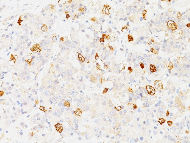 FSH-beta (Follicle Stimulating Hormone-beta) Antibody in Immunohistochemistry (Paraffin) (IHC (P))