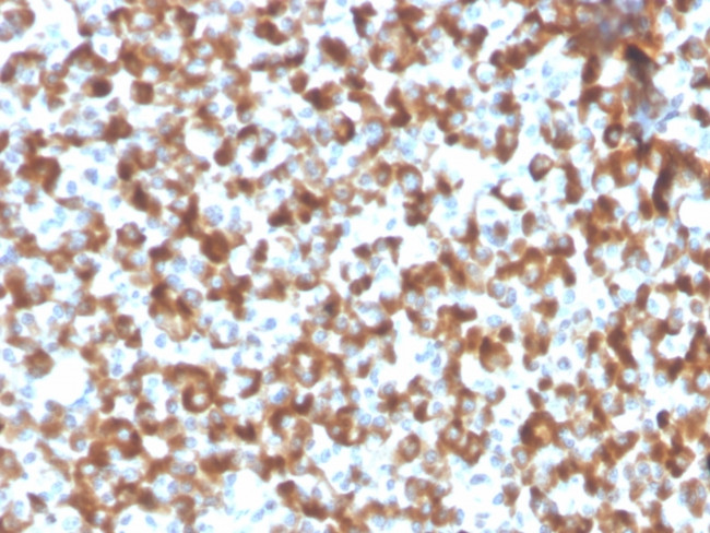 FSH-beta (Follicle Stimulating Hormone-beta) Antibody in Immunohistochemistry (Paraffin) (IHC (P))