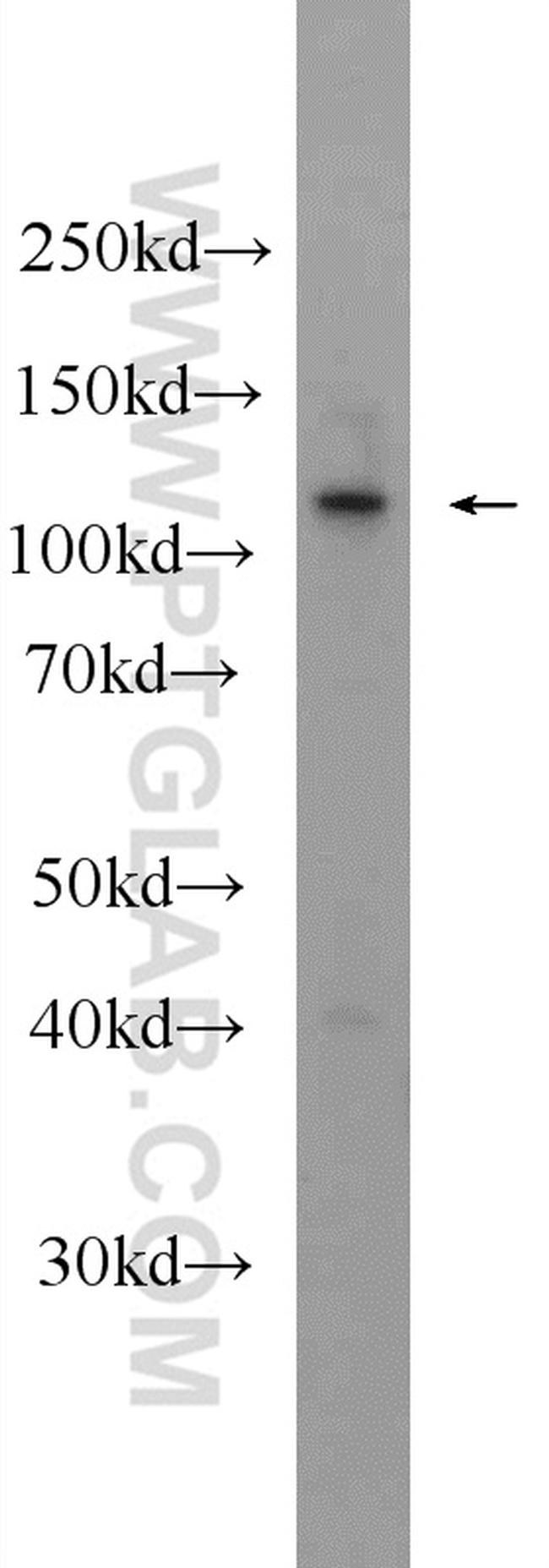 KIAA1217 Antibody in Western Blot (WB)