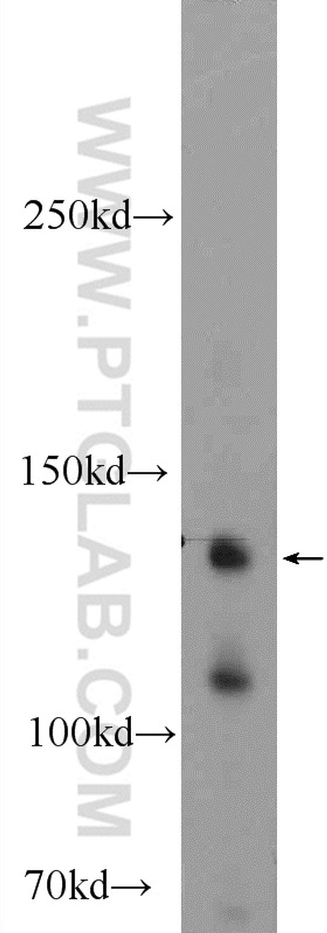 KIAA1217 Antibody in Western Blot (WB)