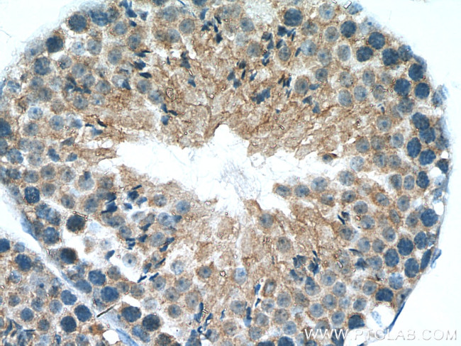 PLEKHO1 Antibody in Immunohistochemistry (Paraffin) (IHC (P))