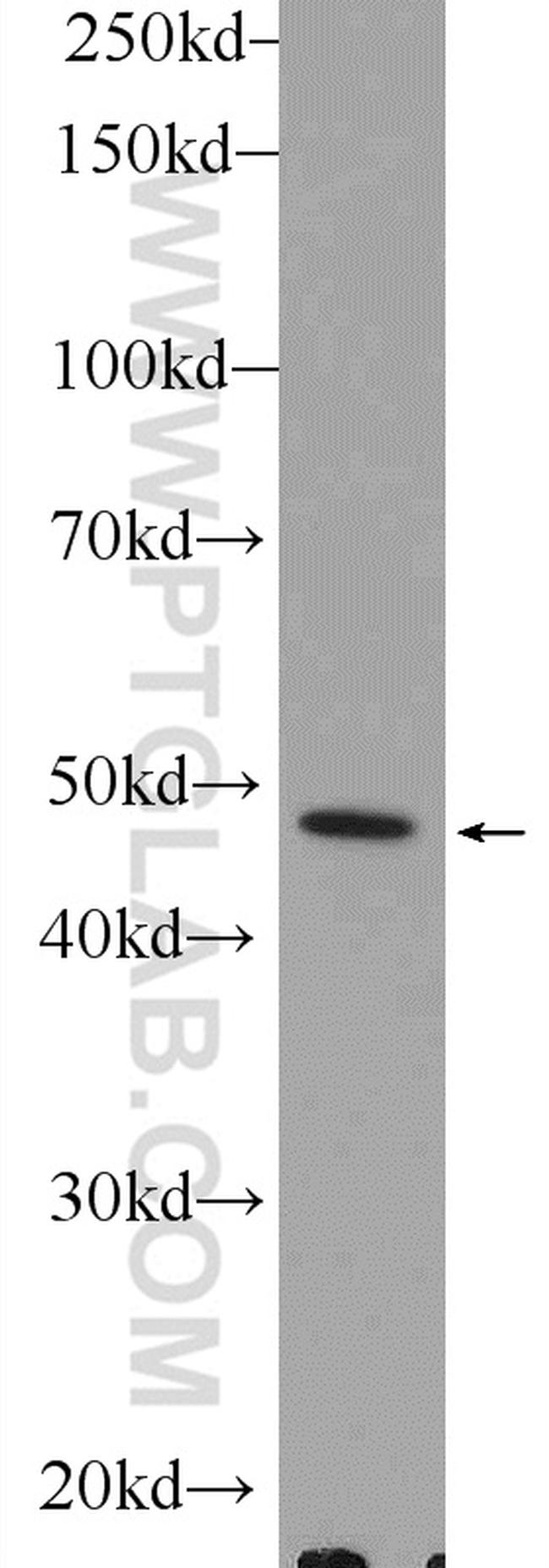 PLEKHO1 Antibody in Western Blot (WB)