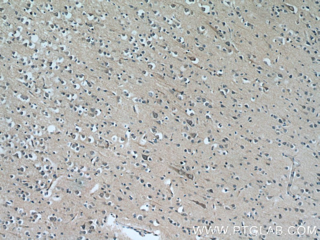 CYP7B1 Antibody in Immunohistochemistry (Paraffin) (IHC (P))