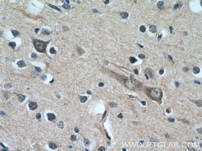 CYP7B1 Antibody in Immunohistochemistry (Paraffin) (IHC (P))