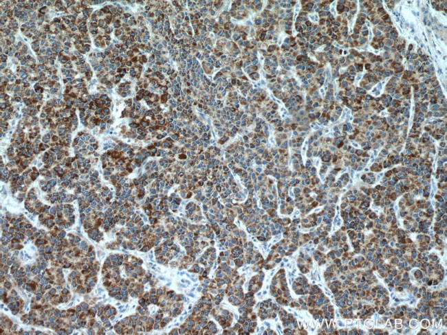 CYP7B1 Antibody in Immunohistochemistry (Paraffin) (IHC (P))