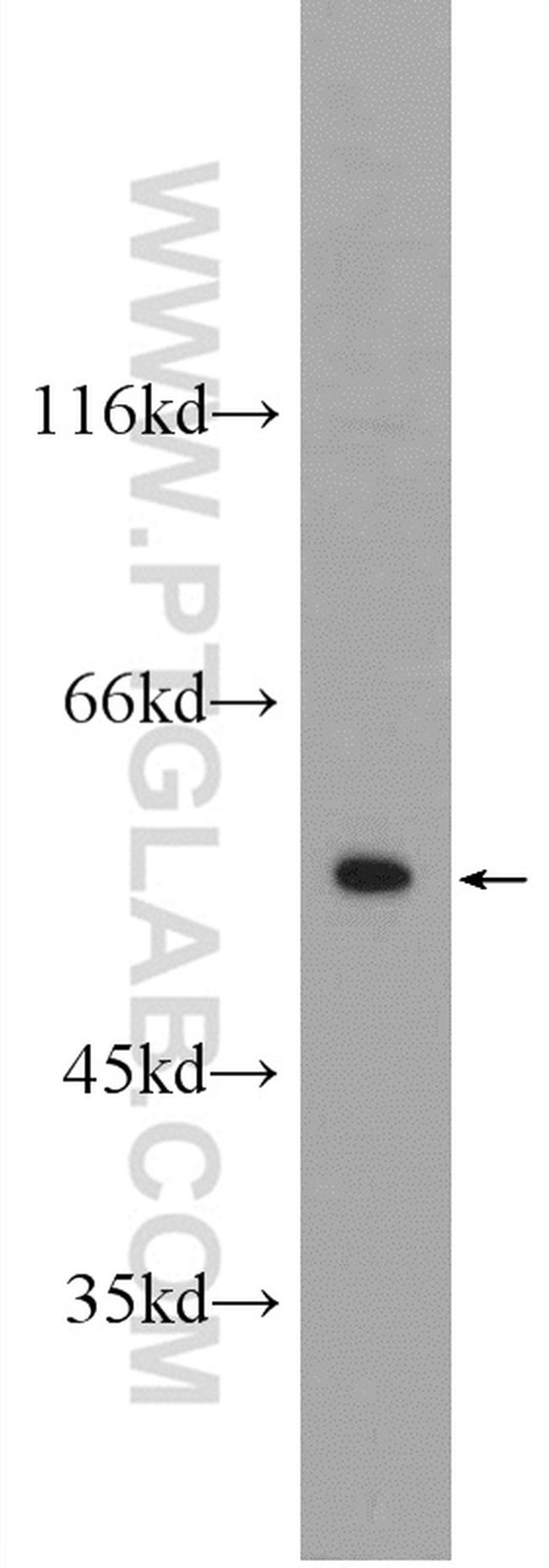 CYP7B1 Antibody in Western Blot (WB)