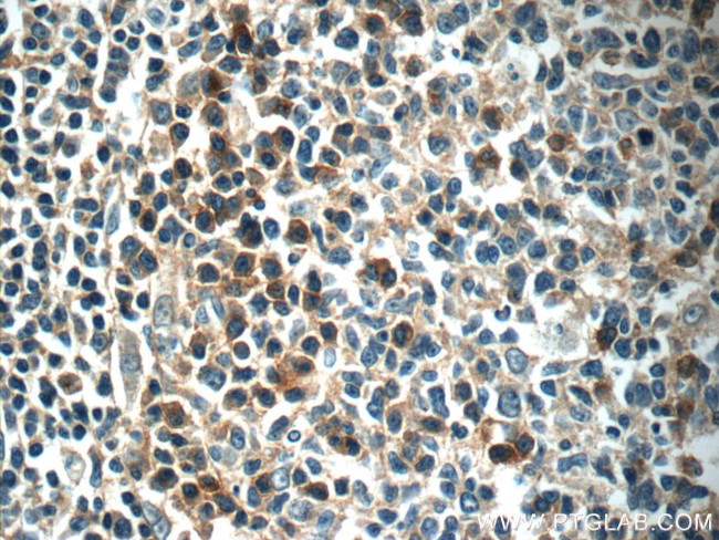 EVI2B Antibody in Immunohistochemistry (Paraffin) (IHC (P))