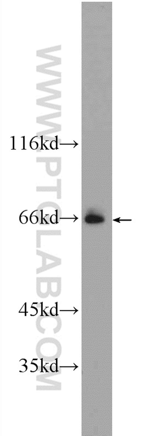 EVI2B Antibody in Western Blot (WB)