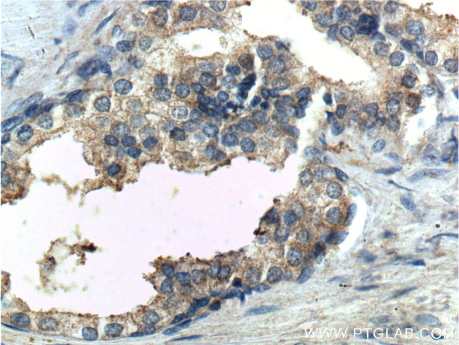 PTGER4 Antibody in Immunohistochemistry (Paraffin) (IHC (P))