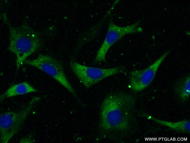 CCT2 Antibody in Immunocytochemistry (ICC/IF)