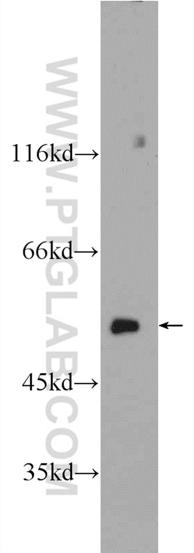 CCT2 Antibody in Western Blot (WB)