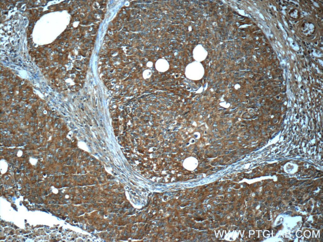 GEMIN5 Antibody in Immunohistochemistry (Paraffin) (IHC (P))