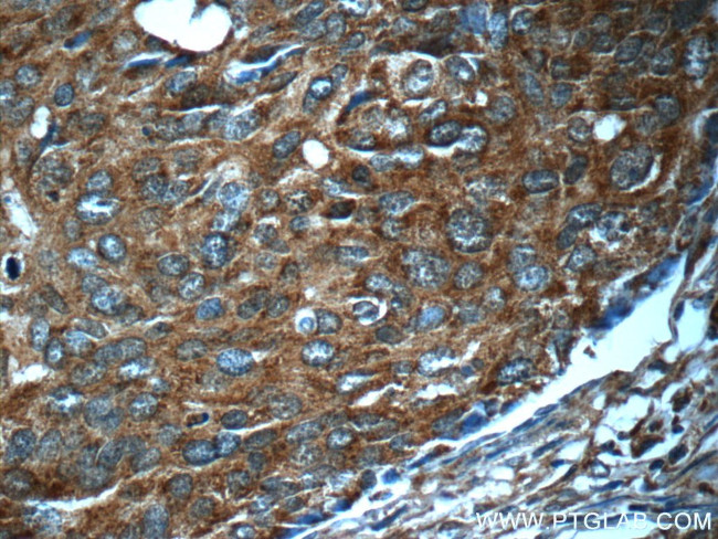 GEMIN5 Antibody in Immunohistochemistry (Paraffin) (IHC (P))