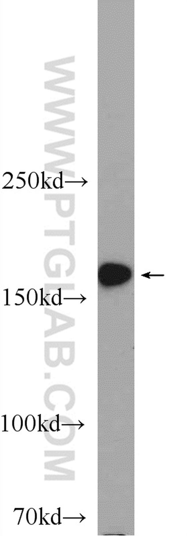 GEMIN5 Antibody in Western Blot (WB)