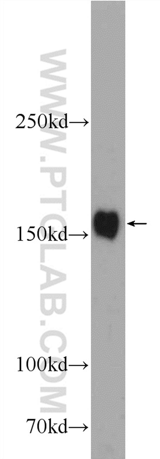 GEMIN5 Antibody in Western Blot (WB)