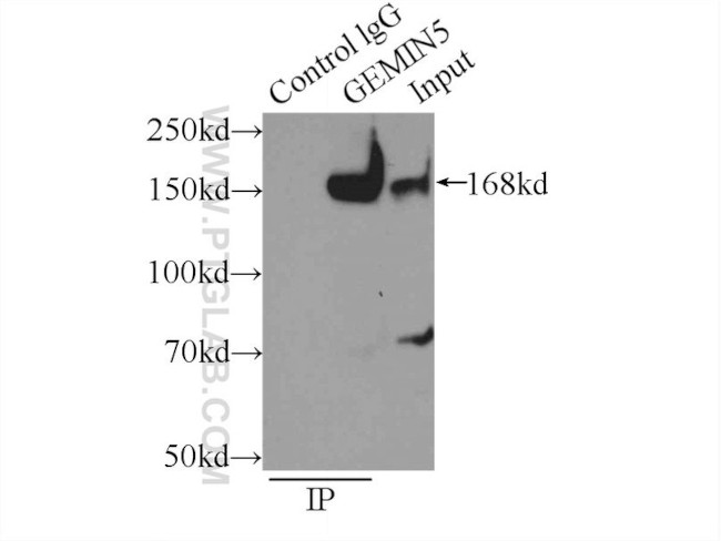 GEMIN5 Antibody in Immunoprecipitation (IP)