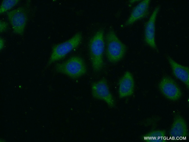 LRP5 Antibody in Immunocytochemistry (ICC/IF)