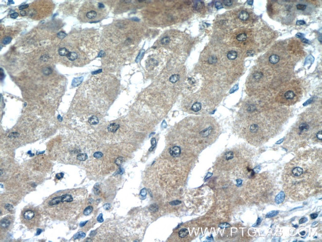 LRP5 Antibody in Immunohistochemistry (Paraffin) (IHC (P))