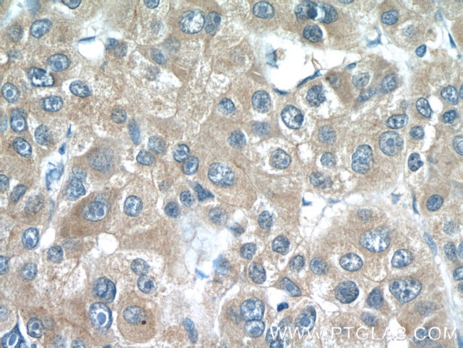 LRP5 Antibody in Immunohistochemistry (Paraffin) (IHC (P))