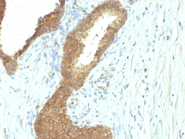 Alkaline Phosphatase (Tissue-Nonspecific) Antibody in Immunohistochemistry (Paraffin) (IHC (P))