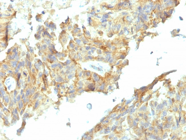 Alkaline Phosphatase (Tissue-Nonspecific) Antibody in Immunohistochemistry (Paraffin) (IHC (P))