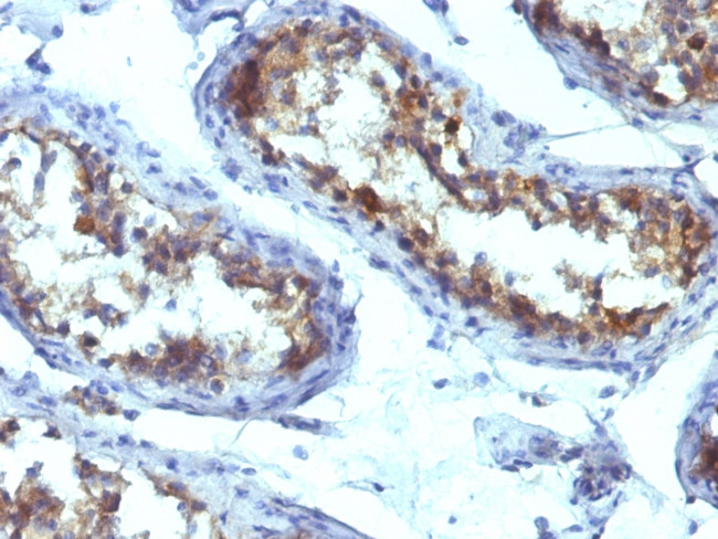 Alkaline Phosphatase (Tissue-Nonspecific) Antibody in Immunohistochemistry (Paraffin) (IHC (P))