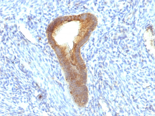 Alkaline Phosphatase (Tissue-Nonspecific) Antibody in Immunohistochemistry (Paraffin) (IHC (P))