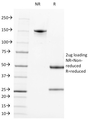 Alkaline Phosphatase (Tissue-Nonspecific) Antibody in SDS-PAGE (SDS-PAGE)