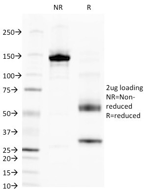 Alkaline Phosphatase (Tissue-Nonspecific) Antibody in SDS-PAGE (SDS-PAGE)