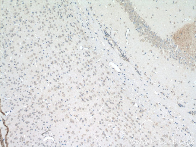 SLC22A23 Antibody in Immunohistochemistry (Paraffin) (IHC (P))