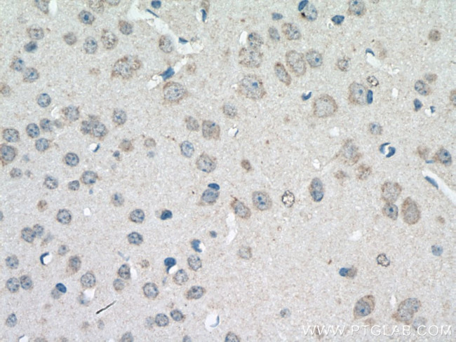 SLC22A23 Antibody in Immunohistochemistry (Paraffin) (IHC (P))