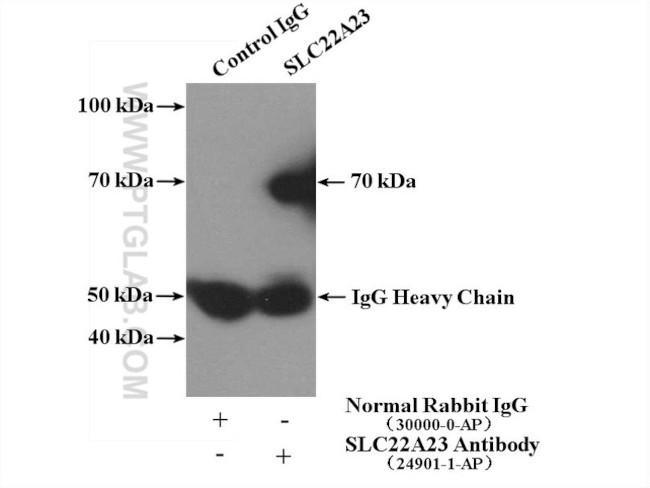 SLC22A23 Antibody in Immunoprecipitation (IP)