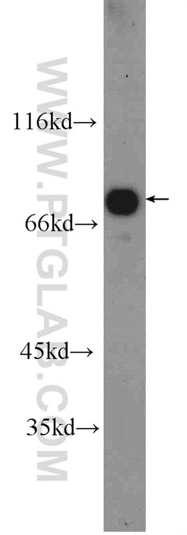 SLC22A23 Antibody in Western Blot (WB)