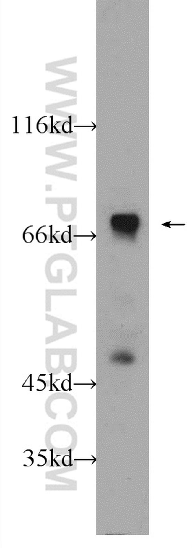 SLC22A23 Antibody in Western Blot (WB)