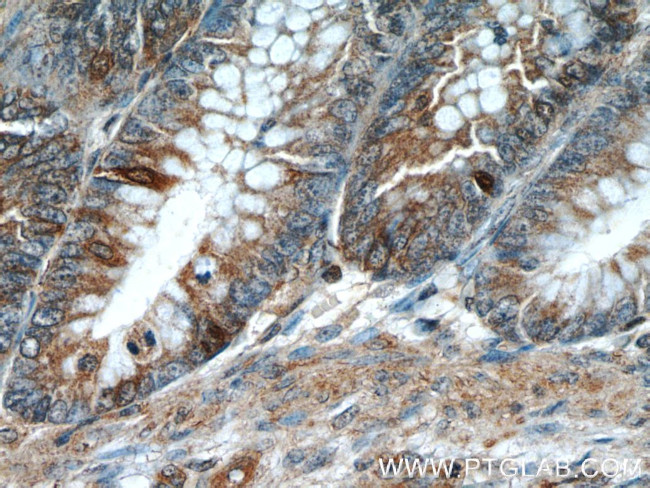 Prokineticin 2 Antibody in Immunohistochemistry (Paraffin) (IHC (P))