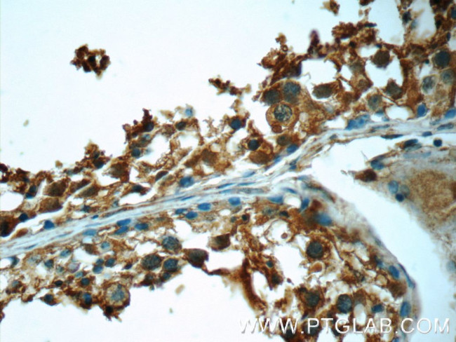 Prokineticin 2 Antibody in Immunohistochemistry (Paraffin) (IHC (P))