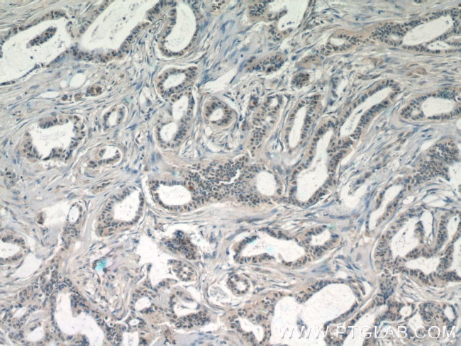 JUN Antibody in Immunohistochemistry (Paraffin) (IHC (P))