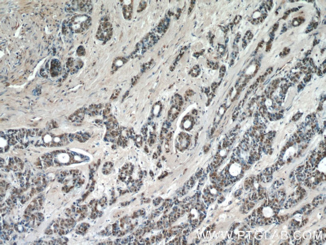 JUN Antibody in Immunohistochemistry (Paraffin) (IHC (P))