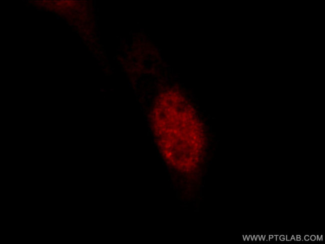 JUN Antibody in Immunocytochemistry (ICC/IF)