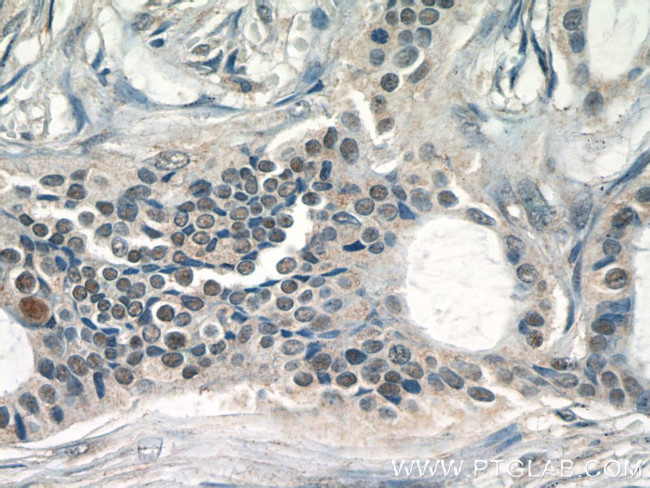 JUN Antibody in Immunohistochemistry (Paraffin) (IHC (P))