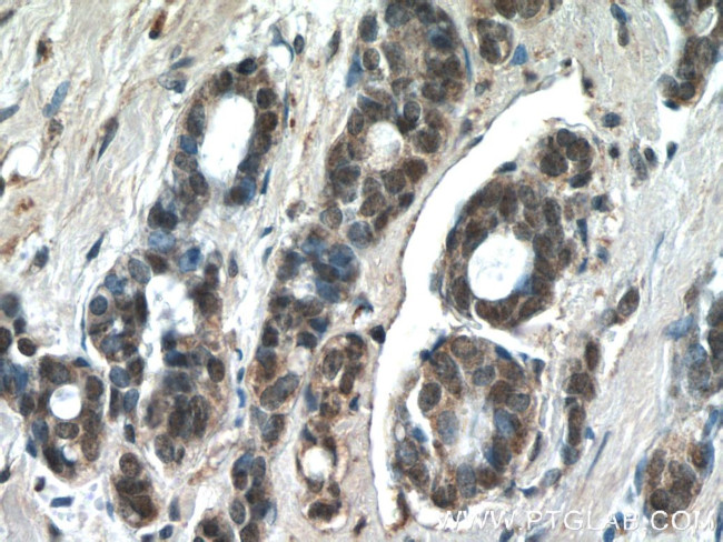 JUN Antibody in Immunohistochemistry (Paraffin) (IHC (P))