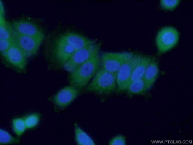 HDAC10 Antibody in Immunocytochemistry (ICC/IF)