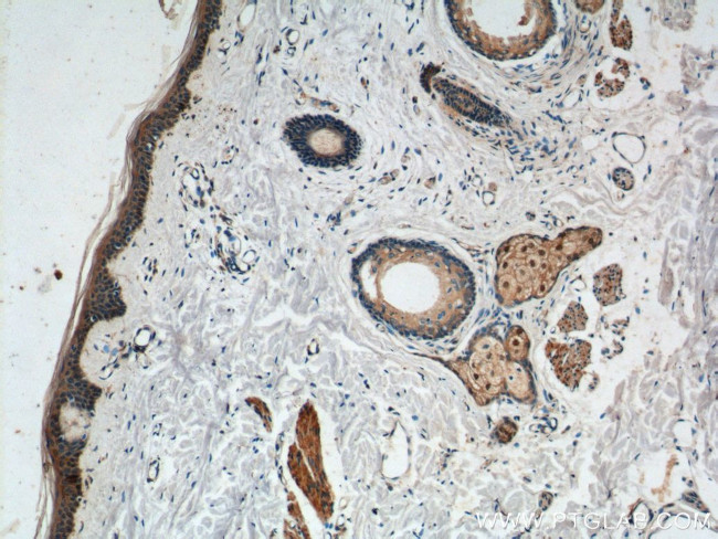 ST8SIA1 Antibody in Immunohistochemistry (Paraffin) (IHC (P))