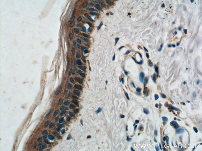 ST8SIA1 Antibody in Immunohistochemistry (Paraffin) (IHC (P))