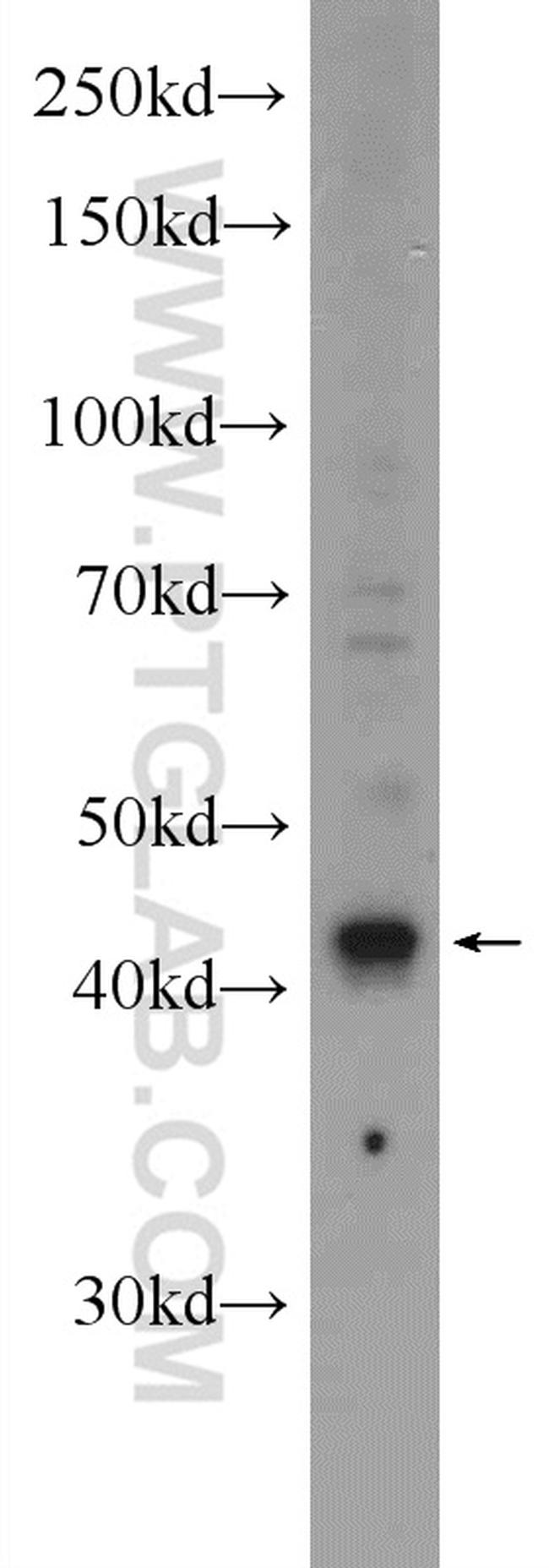 ST8SIA1 Antibody in Western Blot (WB)