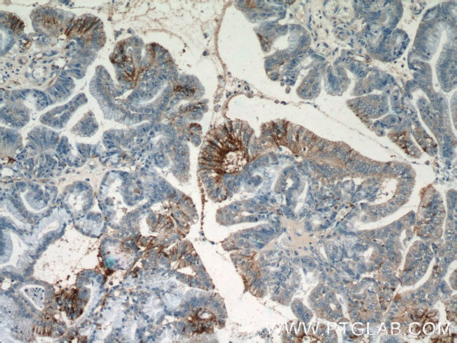 DHX35 Antibody in Immunohistochemistry (Paraffin) (IHC (P))